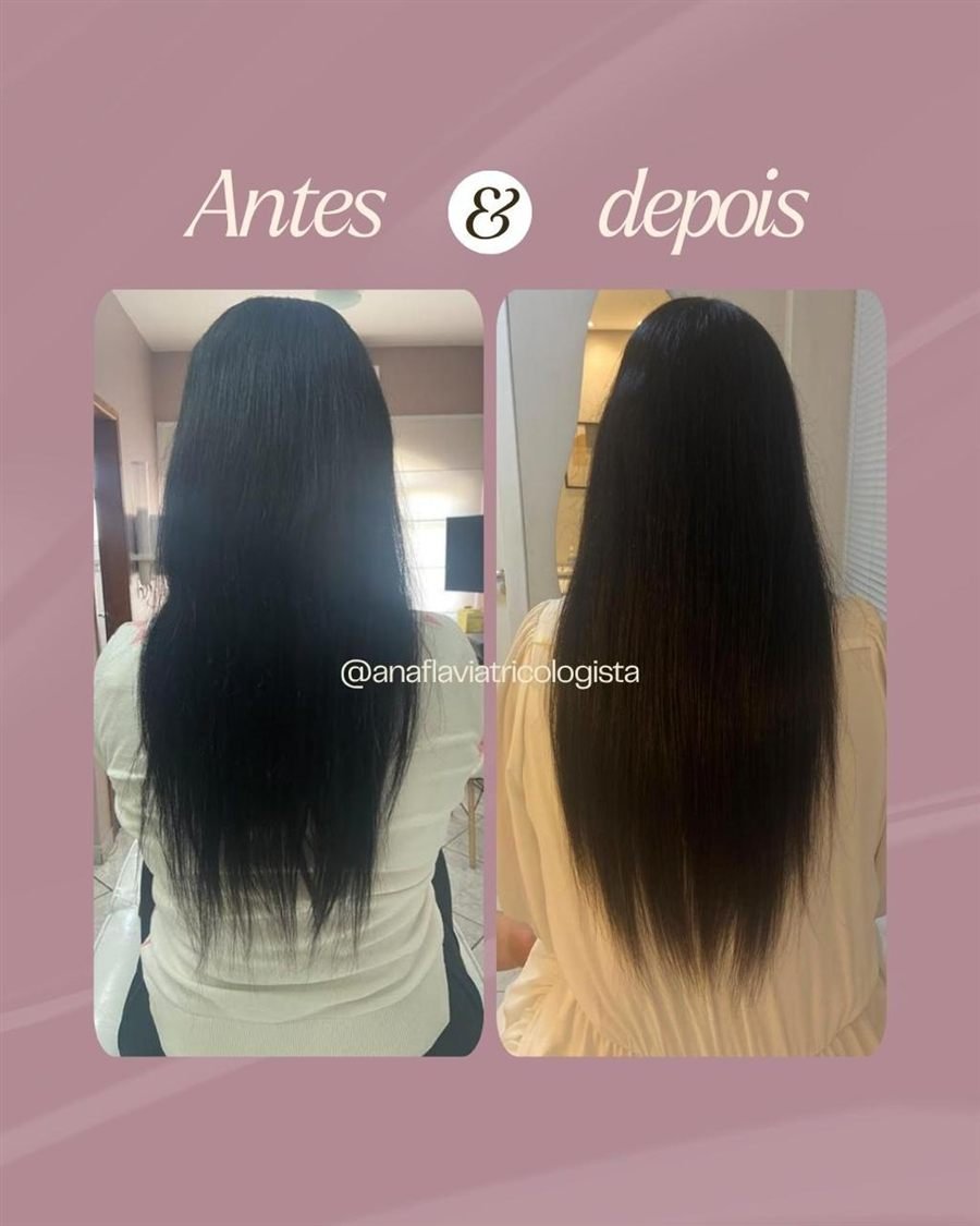 Antes e depois do cabelo de uma paciente, vista por trás, em acompanhamento com a Dra. Ana Flávia